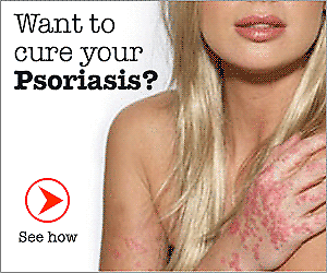 cure psoriasis