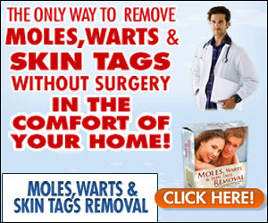 how to get rid of skin tags withoput surgery