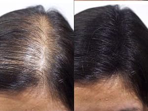 Hair Building Fiber Before After 7