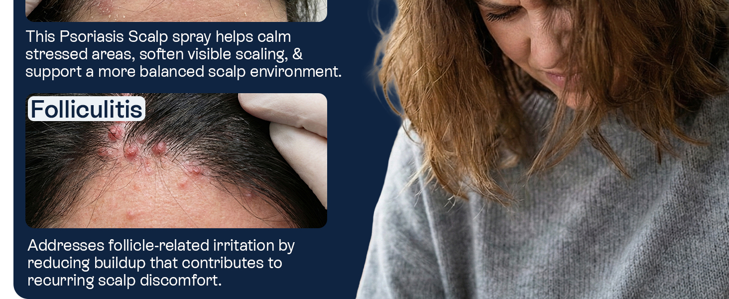 Psoriasis Scalp Spray