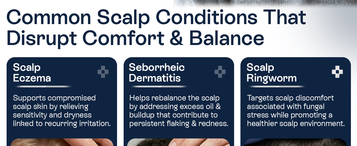 Psoriasis Scalp Spray