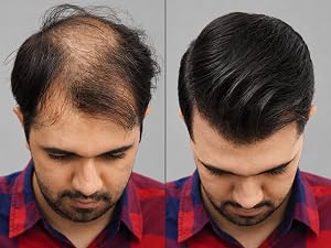 Hair Building Fiber Before After 1