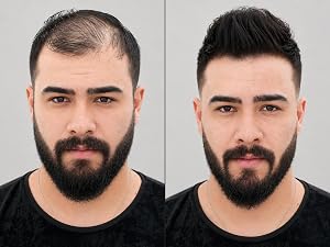 Hair Building Fiber Before After 3