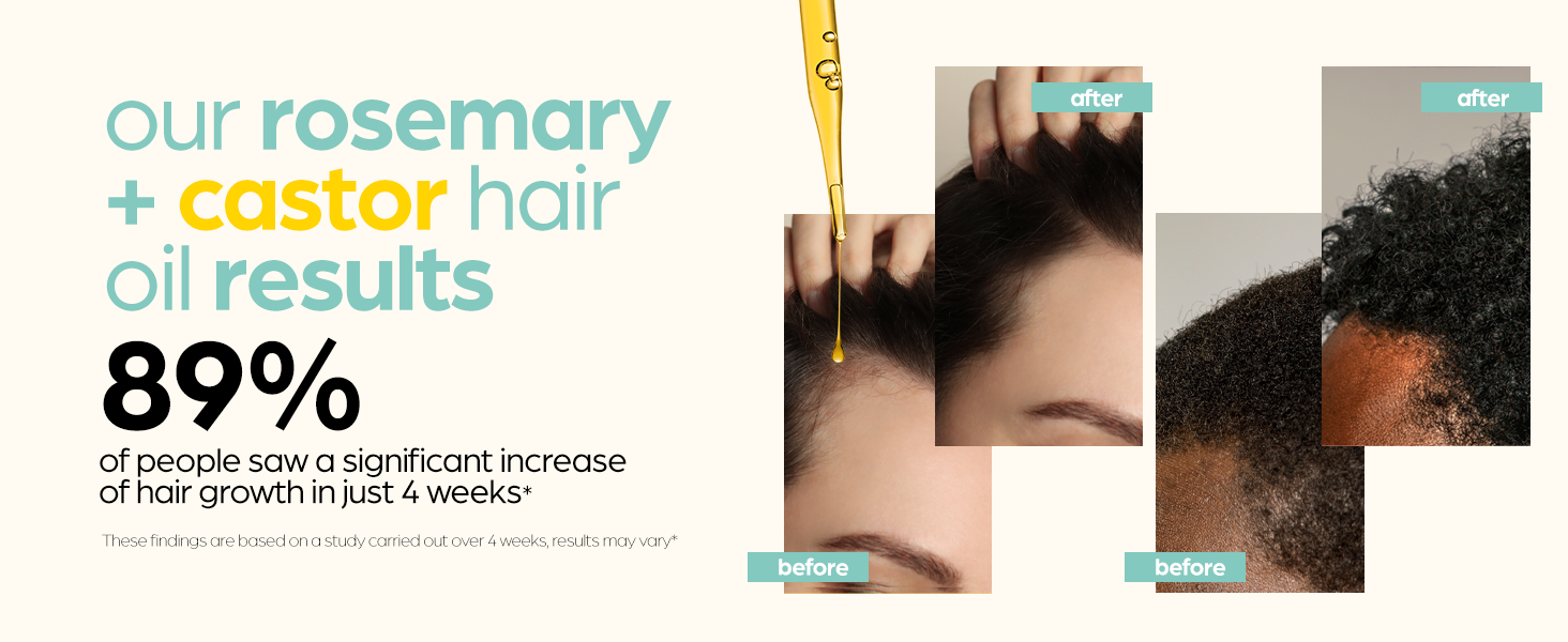 rosemary and castor oil hair growth ki with salp massager by artnaturals