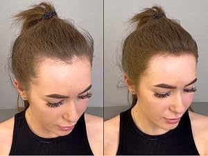 Hair Building Fiber Before After 4