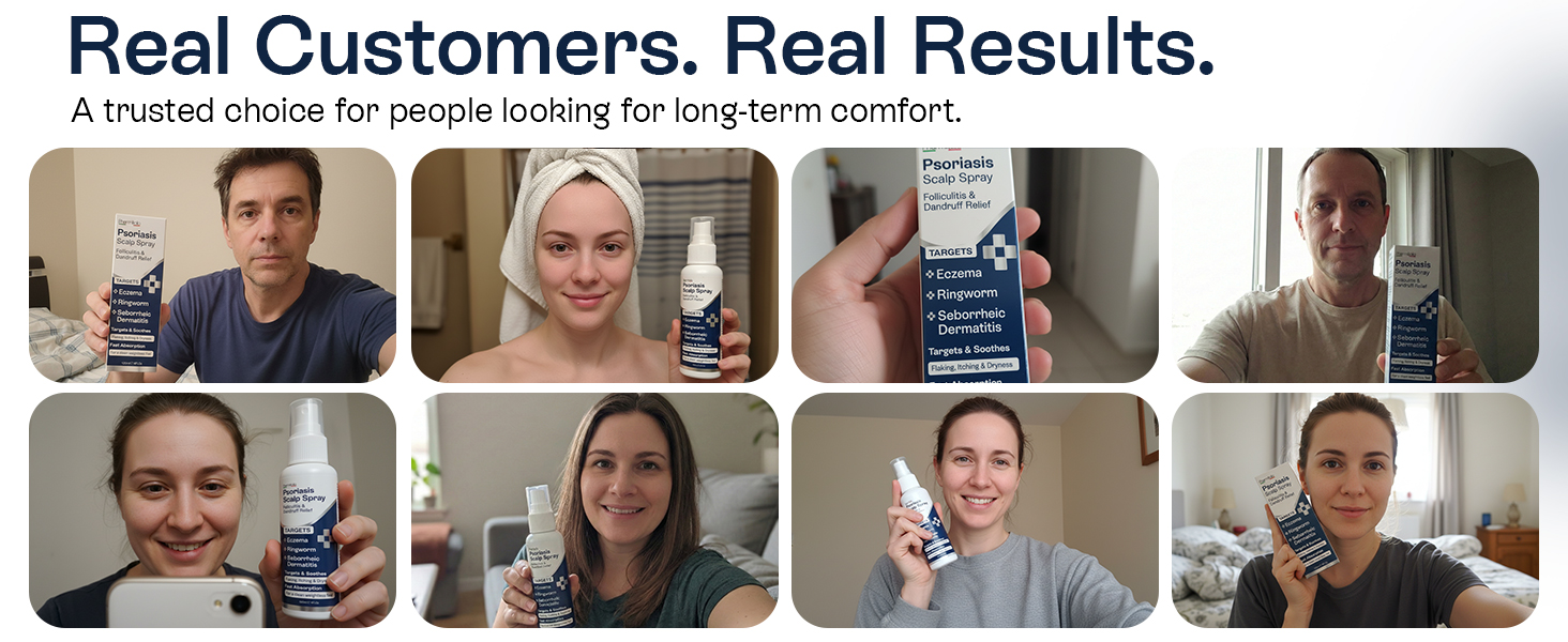 Psoriasis Scalp Spray