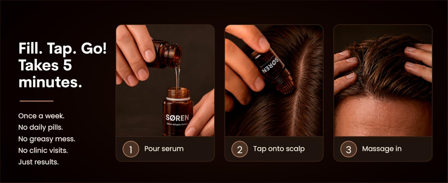SOREN Hair Renewal Microinfusion System