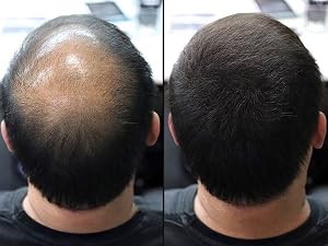 Hair Building Fiber Before After 8